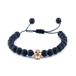 Iron Skull Gold